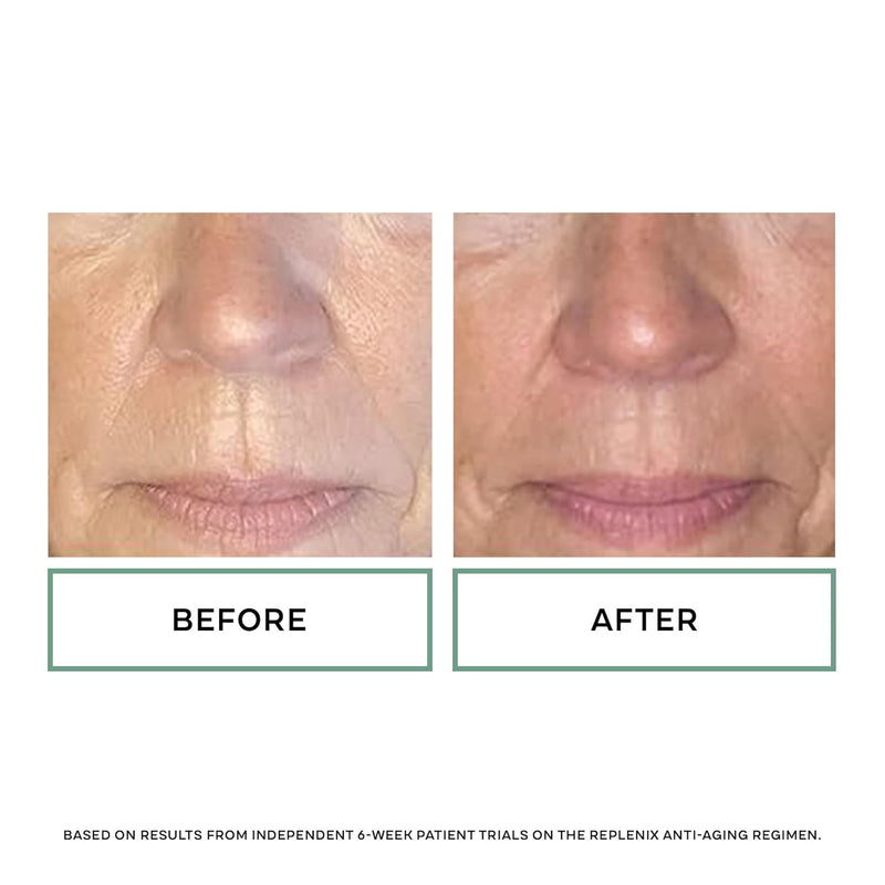 Replenix Antioxidant Hydrating Cleanser, Medical-Grade Gentle Face Wash for Dry & Mature Skin