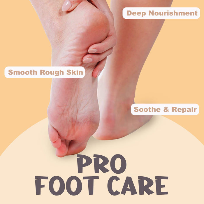 Urea Cream 40 Percent for Dry, Cracked Heels and Feet with Coconut Oil & Vanilla Planifolia, Callus Remover and Skin Softener, Maximum Strength Foot & Hand Cream – 1.41 oz