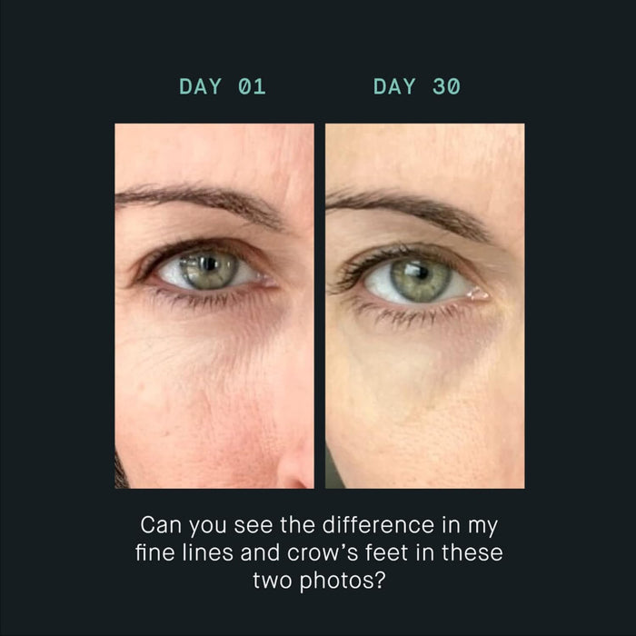 OneSkin EYE OS-01 Peptide Topical Supplement | Skin Longevity Age Reversal Eye Cream | Safe for Sensitive Skin, Fragrance-Free