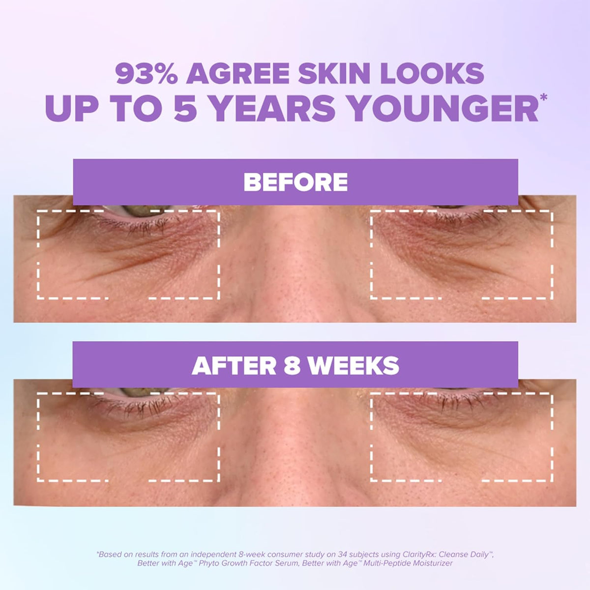 ClarityRx Better With Age Phyto Growth Factor Face Serum, 0.9 Fl Oz, Anti-Aging Hydrating Serum with Plant Stem Cells, Helps Support Collagen & Hyaluronic Acid Production, Visibly Smooths Fine Lines