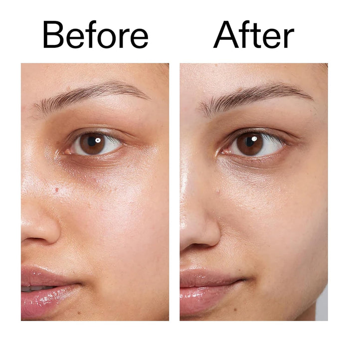 The INKEY List Caffeine Eye Cream - Reduces Dark Circles, Brightens & Depuffs, Targeted Eye Treatment