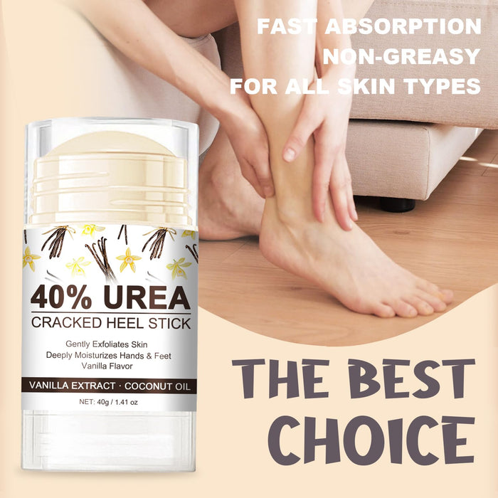 Urea Cream 40 Percent for Dry, Cracked Heels and Feet with Coconut Oil & Vanilla Planifolia, Callus Remover and Skin Softener, Maximum Strength Foot & Hand Cream – 1.41 oz