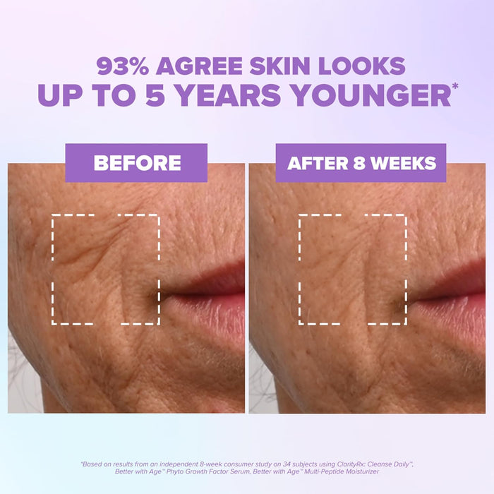 ClarityRx Better With Age Phyto Growth Factor Face Serum, 0.9 Fl Oz, Anti-Aging Hydrating Serum with Plant Stem Cells, Helps Support Collagen & Hyaluronic Acid Production, Visibly Smooths Fine Lines