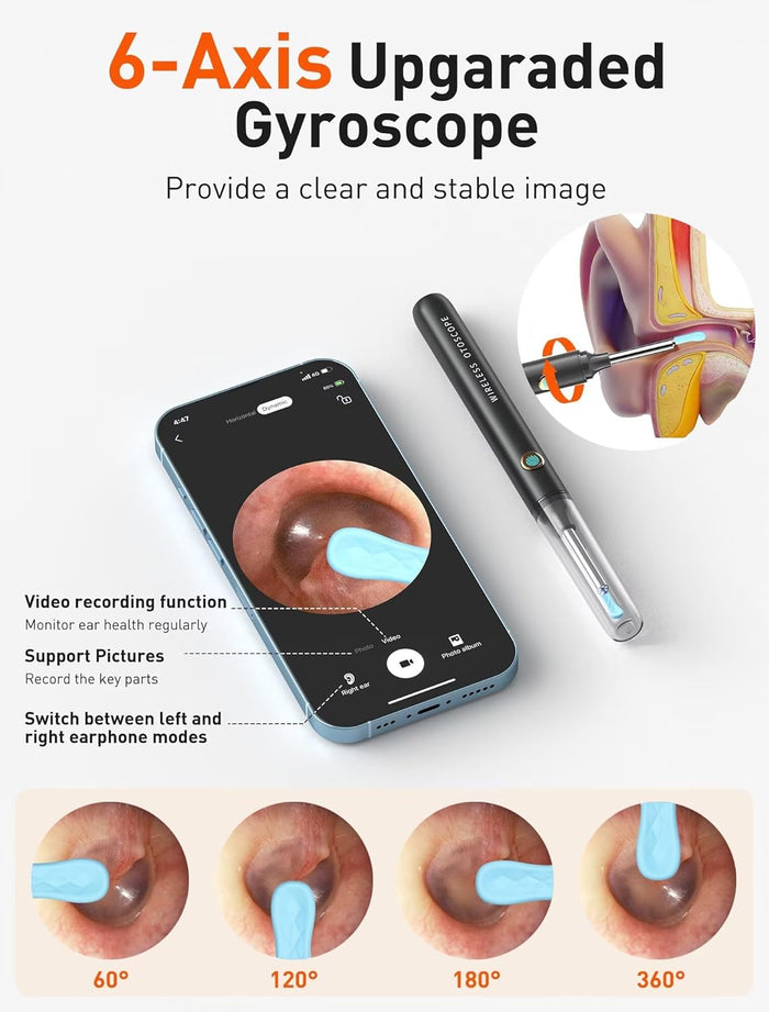 Ear Wax Removal Tool Camera - Ear Cleaner with 1080P HD Camera, FSA - HSA Store Eligible, Otoscope with Light, Earwax Removal Kit with 50 Replacement Tips for iPhone, iPad, Android Phones (Black)