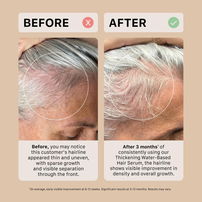 ACTIIV Thickening Hair Serum - Water Based | Supports the Appearance of Thicker, Fuller-Looking Hair, Lightweight Water-Based Formula, Non-Greasy, All Hair Types, 1.8 oz