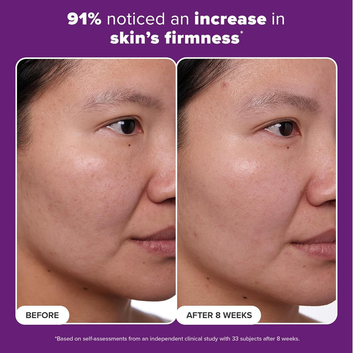 Paula's Choice CLINICAL 1% Retinol Face Moisturizer Treatment with Peptides, Vitamin C & Licorice Extract, Firming Face Cream, Anti-Aging & Wrinkles, Fragrance Free