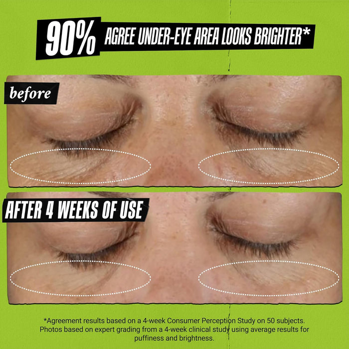Kiehl's Avocado Eye Treatment, Under Eye Cream for Puffiness and Dark Circles, with Caffeine to Correct Bags, 99% Naturally Derived Non-Toxic Formula