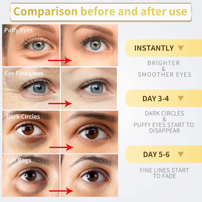 24K Gold Under Eye Patches - 60 Pack for Puffy Eyes, Dark Circles, Bags & Wrinkles with Collagen & Hyaluronic Acid - Eye Care Pads for Daily Skincare (Gold)