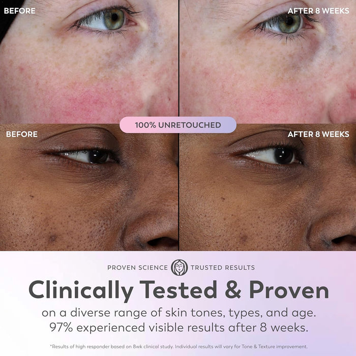 Olay Super Serum - Niacinamide, Vitamin C & E, Collagen Peptide, AHA - 5-in-1 Skin Care Benefits for Face - Healthy Glow, Brightening, Hydrating, Smoothing, Firming, Evens Tone, Anti-Aging, 1.0 Oz
