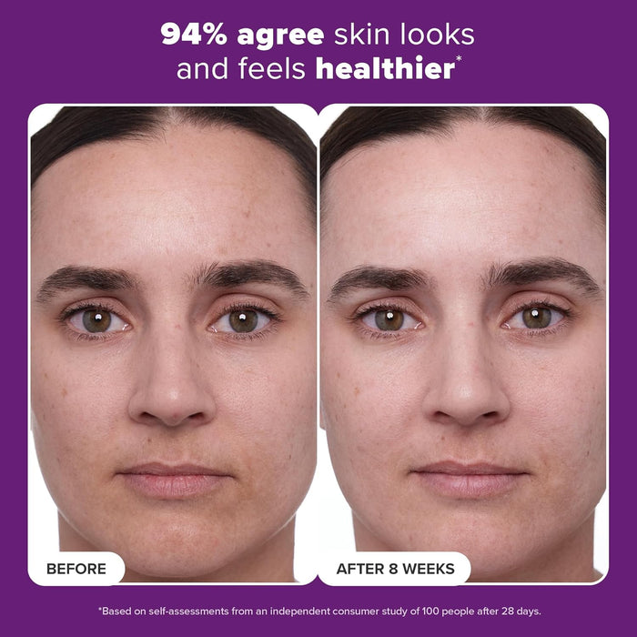 Paula's Choice CLINICAL 1% Retinol Face Moisturizer Treatment with Peptides, Vitamin C & Licorice Extract, Firming Face Cream, Anti-Aging & Wrinkles, Fragrance Free