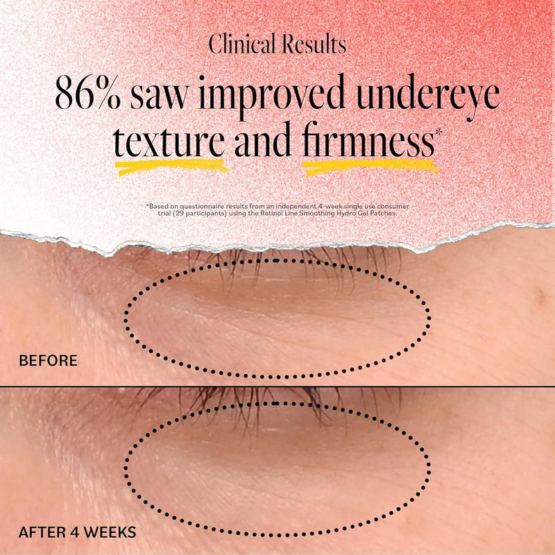 Derma E Retinol + Bakuchiol Under Eye Patches (30 Pairs) Non-Irritating, Line Smoothing Hydro Gel Eye Patches with Rose Water & Real Hibiscus Petals, Helps Reduce Fine Lines, Crow's Feet, 60ct