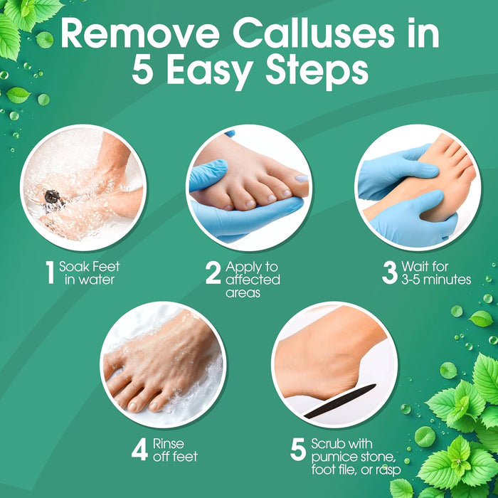 DeEnti Callus Remover for Feet, Extra Strength Foot Callus Remover Gel, 8oz Salon Grade Home Pedicure Supplies for Dry Skin, Cracked Heel, Professional Strength Foot Care, Cool Mint