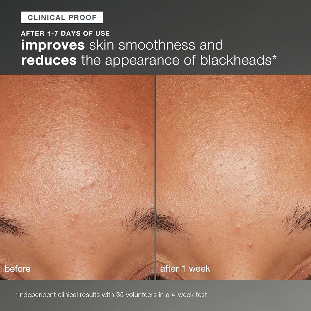 Dermalogica Daily Microfoliant, Face Exfoliator Scrub Powder with Salicylic Acid and Papaya Enzyme, Achieve Brighter, Smoother Skin Daily