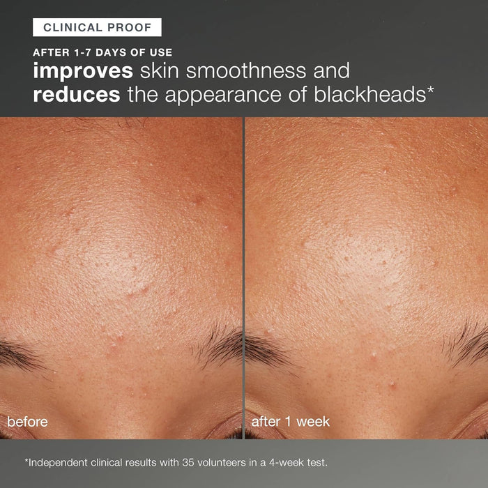 Dermalogica Daily Microfoliant, Face Exfoliator Scrub Powder with Salicylic Acid and Papaya Enzyme, Achieve Brighter, Smoother Skin Daily