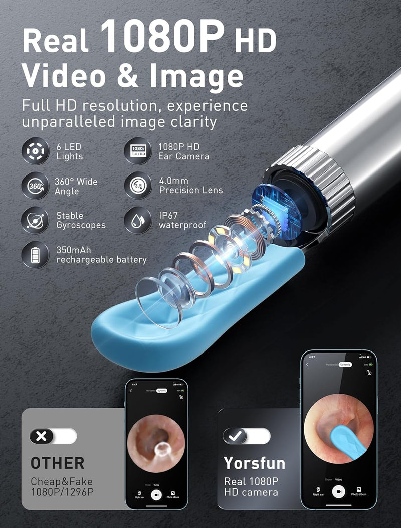 Ear Wax Removal Tool Camera - 3 in 1 Wireless WiFi Rechargeable Ear Cleaner with Camera, 1080P HD Ear Camera & 7 Pcs Ear Set, Ear Cleaning Kit with 15 Replacement Tips, Black