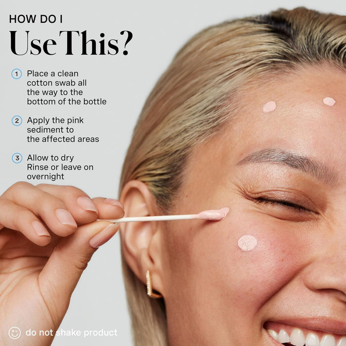 Kate Somerville EradiKate Acne Treatment - Clinically Formulated 10% Sulfur and BHA Spot Treatment – Clears Pimples, Cleans Pores and Prevents Breakouts, 1 Fl Oz