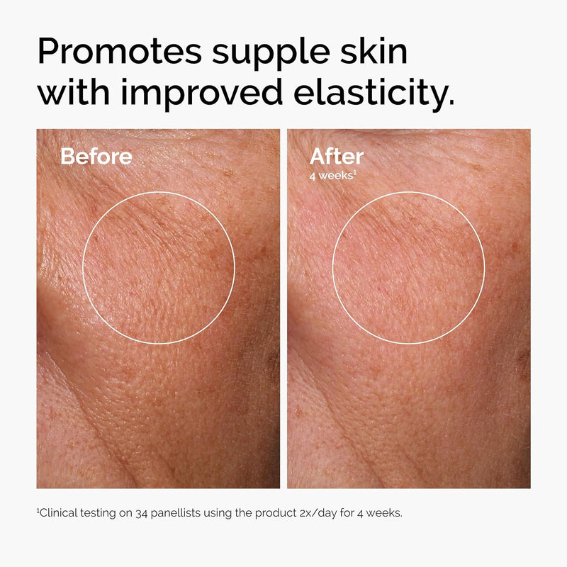The Ordinary Serum Favorites Set – Hyaluronic Acid 2% + B5, Niacinamide 10% + Zinc 1%, Caffeine Solution 5% – Eye and Face Serums for Hydrating, Brightening & Pore-Minimizing Skin Care