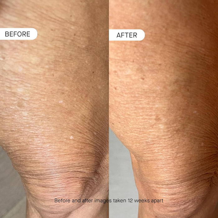 OneSkin BODY OS-01 Peptide Topical Supplement & Skin Longevity Age Reversal Moisturizer | Safe for Sensitive Skin, Fragrance-Free