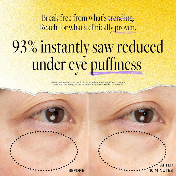 Derma E Vitamin C Bright Eyes Hydro Gel Under Eye Patches for Dark Circles (60 Ct, 30 Pairs) Allantoin, Caffeine & Vitamin B3, Collagen Eye Patches for Fine Lines, Wrinkles, Dark Circles & Puffy Eyes