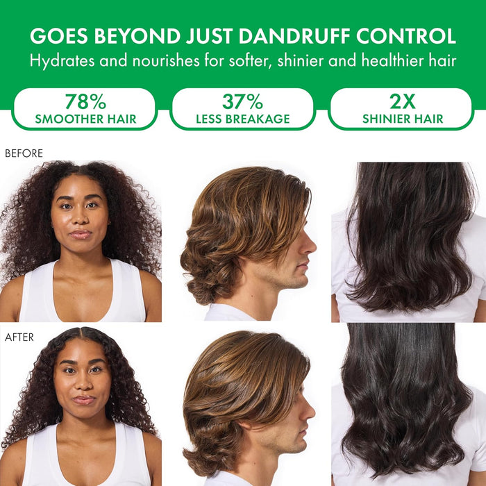Dercos Dandruff Shampoo, Antifungal Dry Scalp Treatment & Itchy Scalp Relief, Prescription Strength Selenium Sulfide Comparable to 2% Ketoconazole, For Mild to Severe Dandruff & Flaky Scalps